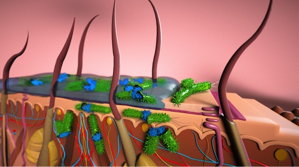 skin bacteria